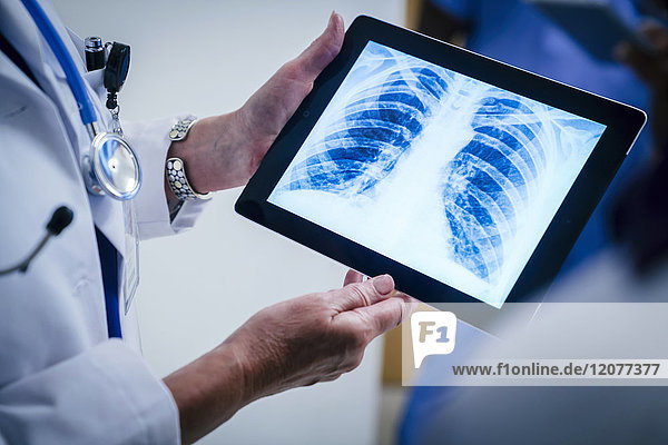 Ärzte untersuchen Röntgenaufnahmen von Brust und Rippen auf einem digitalen Tablet