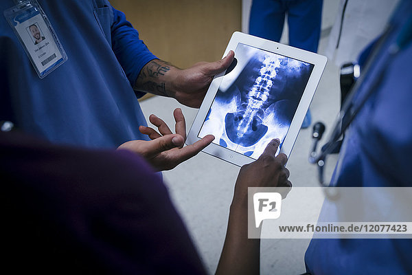 Ärzte untersuchen Röntgenaufnahmen von Becken und Wirbelsäule auf einem digitalen Tablet