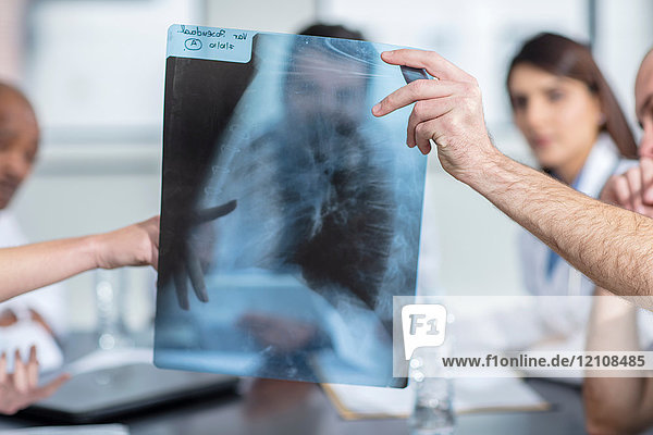 Gruppe von Ärzten am Tisch sitzend  Diskussion Röntgenaufnahme des Patienten