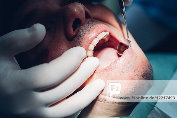 Zahnarzt  der einen zahnärztlichen Eingriff an einem männlichen Patienten vornimmt  Nahaufnahme