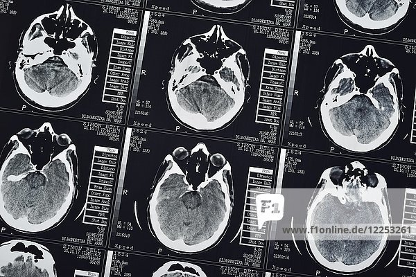 CT-Scan eines männlichen Gehirns  Nahaufnahme