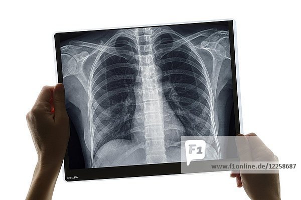 Untersuchung einer Röntgenaufnahme der Brust