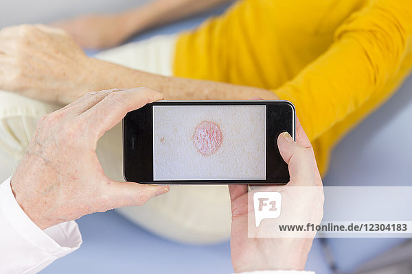 Doctor photographing skin lesions of a patient (psoriasis).