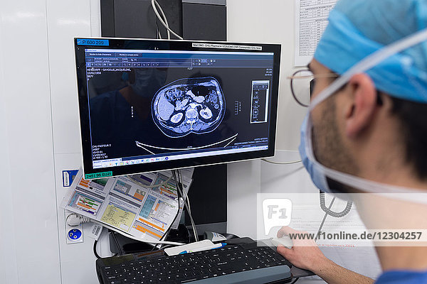 Reportage on a kidney transplant in the urology service of Nice Hospital  France. The kidney is taken from a living related donor  the recipient’s wife. The intern examines the donor’s scan.