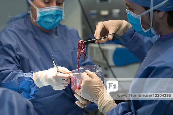 Reportage im gynäkologischen Operationssaal der Lenval-Klinik  Nizza  Frankreich. Laparoskopische Entfernung eines Ovarialendometriums (Endometriose  die eine Zyste im Eierstock bildet). Der Chirurg begutachtet die Reste der Zyste.