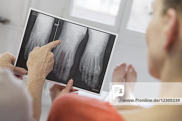Digitales Röntgenbild des rechten Fußes.