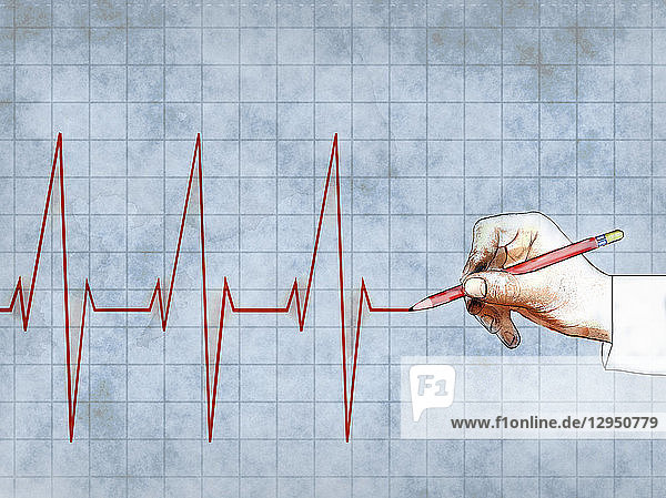Männerhand zeichnet EKG