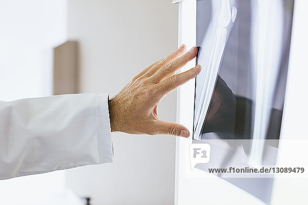 Nahaufnahme eines Arztes  der das Röntgenbild in einer medizinischen Klinik berührt
