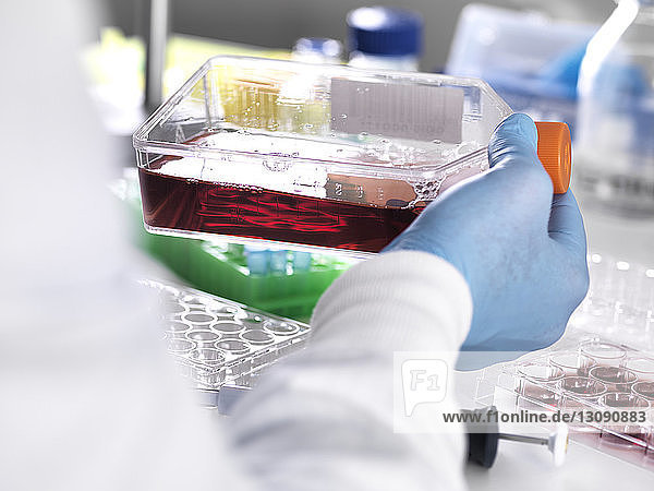 Nahaufnahme eines Labortechnikers  der eine Blutprobe in einem Behälter für medizinische Tests aufbewahrt