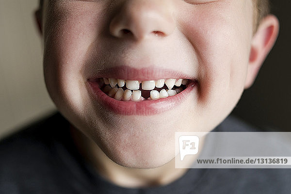 Nahaufnahme eines Jungen mit Zahnlücke