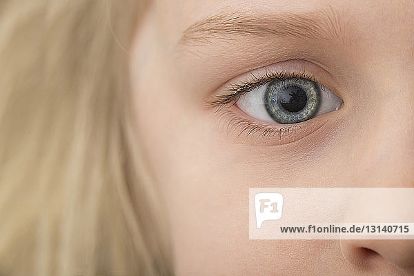 Close-up of girl with gray eye