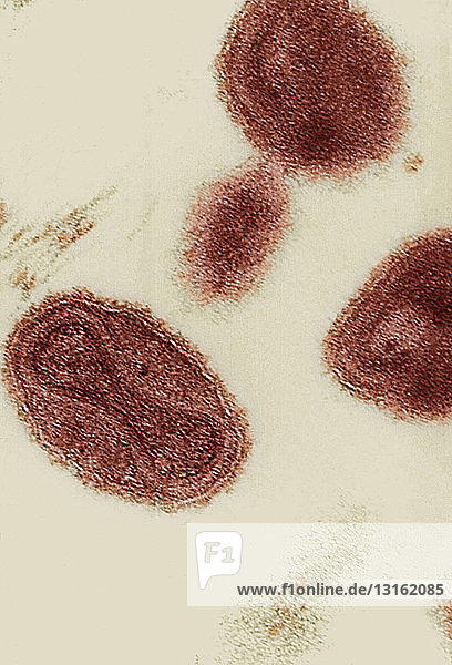 EM image variola (smallpox) viruses