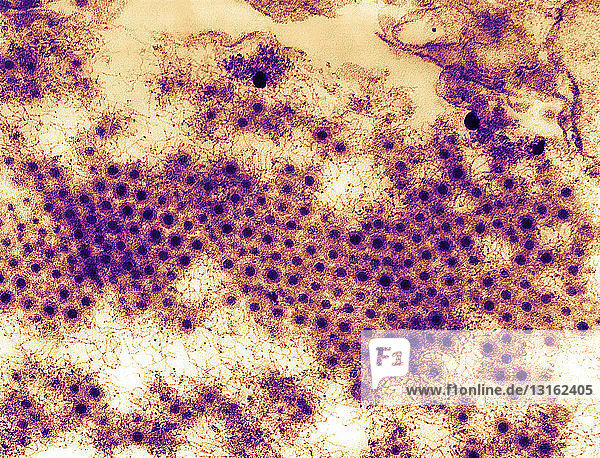 TEM of Reovirus type-3