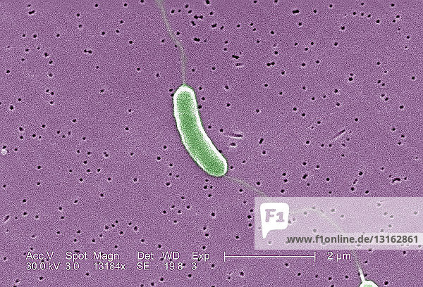 SEM von Vibrio vulnificus-Bakterien