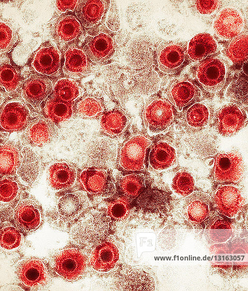 Elektronenmikroskopische Aufnahme  Herpes-Virus