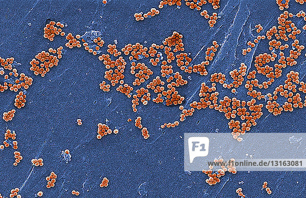 REM von Methicillin-resistentem Staphylococcus aureus