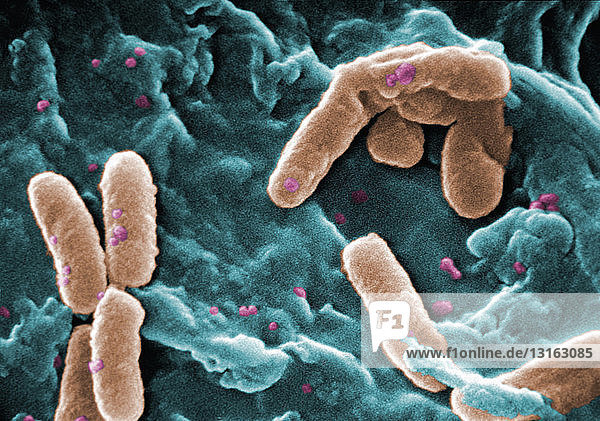 SEM of Pseudomonas aeruginosa bacteria