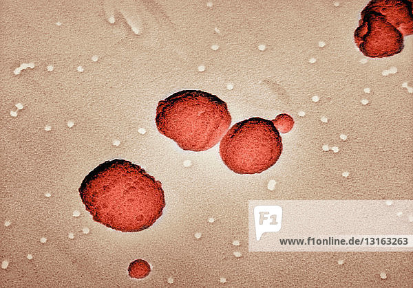 Electron micrograph of Streptococcus pneumoniae
