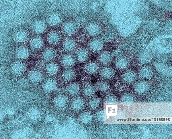 TEM of norovirus virions