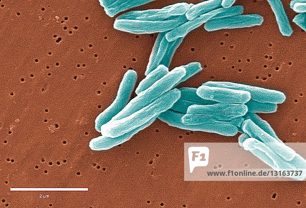 Elektronenmikroskopische Aufnahme von Mycobacterium tuberculosis