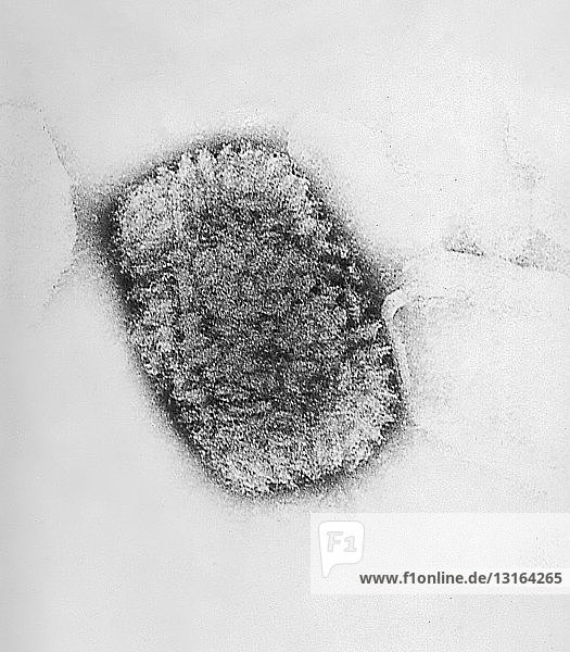 Electron micrograph of a Vaccinia virus