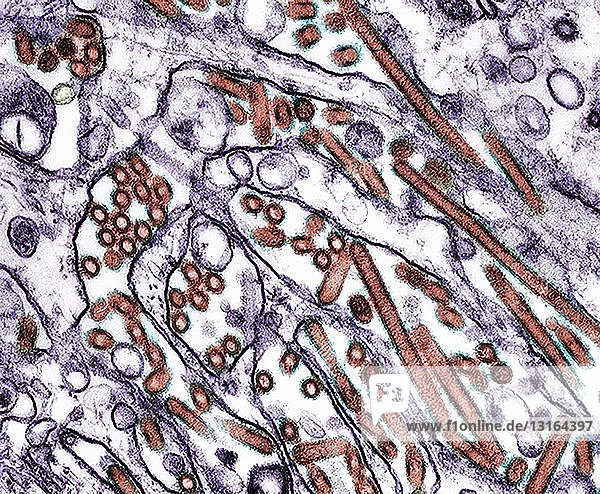 TEM ( of Avian influenza A H5N1 viruses