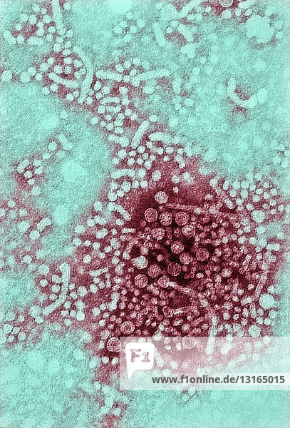TEM,  des Hepatitis-B-Virus