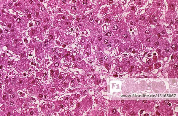 Lichtmikroskopische Aufnahme von Leberzellen mit Ebola-Virus