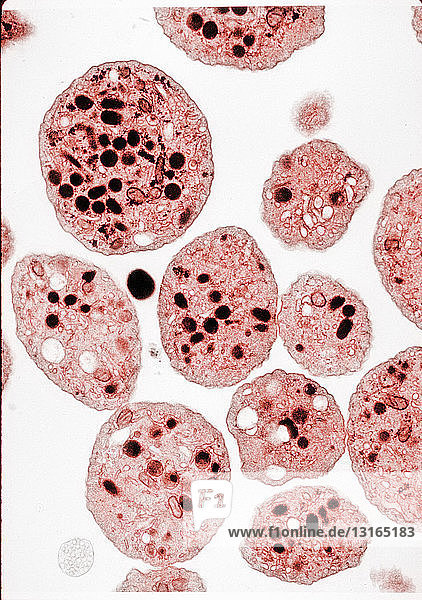 TEM image of human platelets