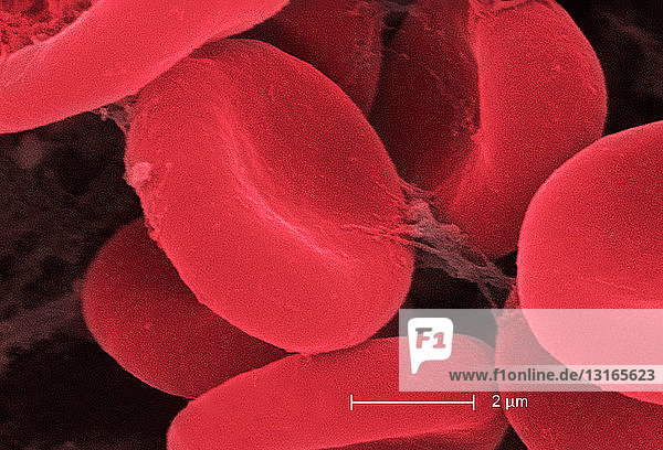 Elektronenmikroskopische Aufnahme von roten Blutkörperchen und Fibrin