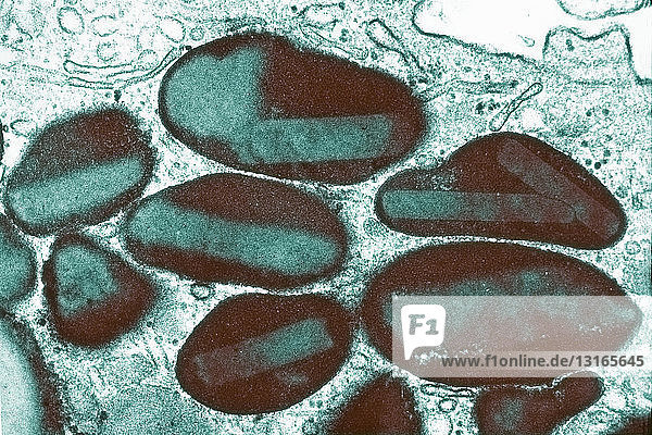 TEM of human eosinophil white blood cell