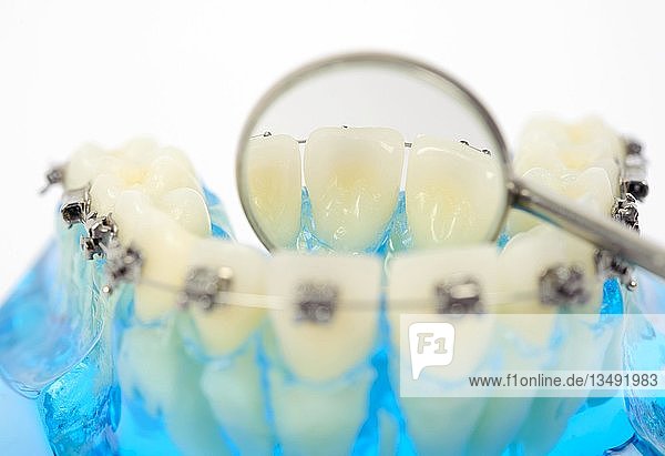 Zahnhygiene  Zahnersatz mit fester Zahnspange und ein Zahnspiegel