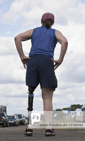 Frau mit Beinprothese steht auf der Straße