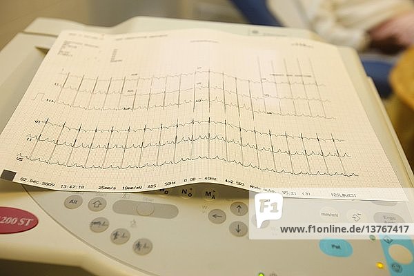 Elektrokardiogramm  Frankreich