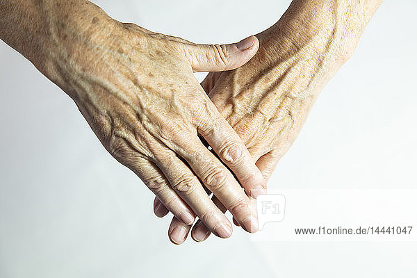 Hands with spots of old age
