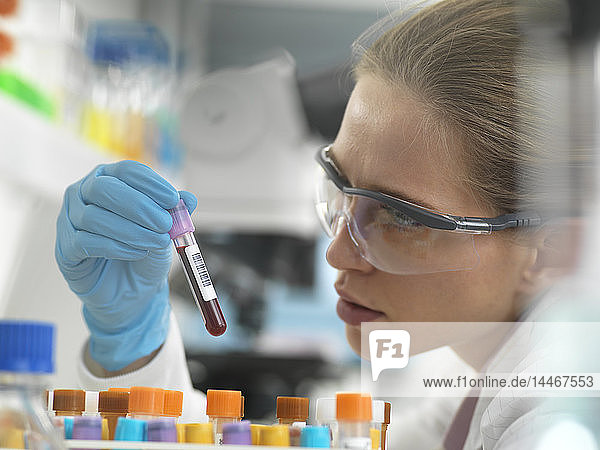 Gesundheitsscreening  Wissenschaftlerin hält ein Röhrchen mit einer Blutprobe zur Analyse im Labor bereit
