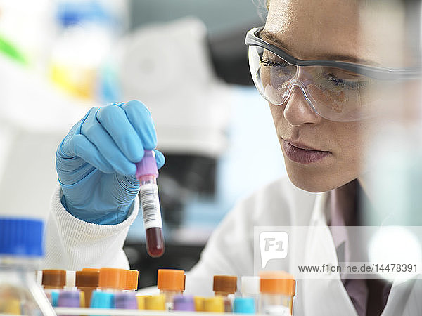 Health Screening  Scientist holding a tube containing a blood sample ready for analysis in the laboratory
