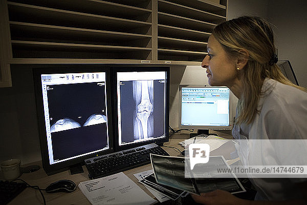 Reportage in einem radiologischen Zentrum in Haute-Savoie  Frankreich. Ein Techniker sieht sich eine Röntgenaufnahme des Knies an  die Anzeichen von Arthrose zeigt.