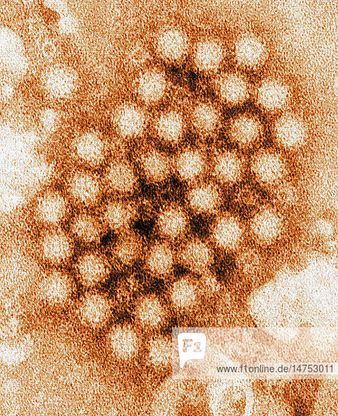 Diese kolorierte Transmissions-Elektronenmikroskopie (TEM) zeigt einen Teil der ultrastrukturellen Morphologie von Norovirus-Virionen bzw. Viruspartikeln.
