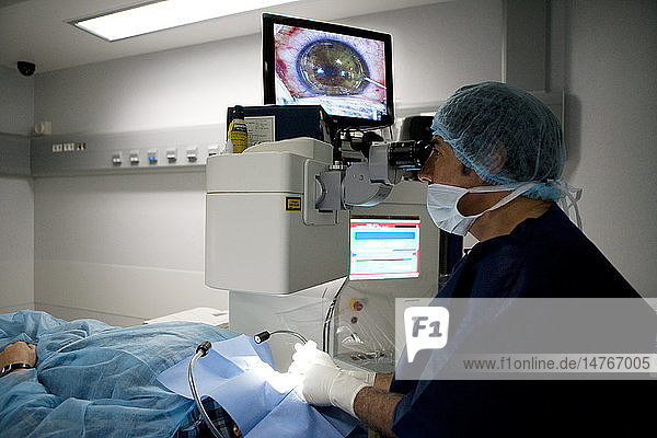 EYE LASER SURGERY