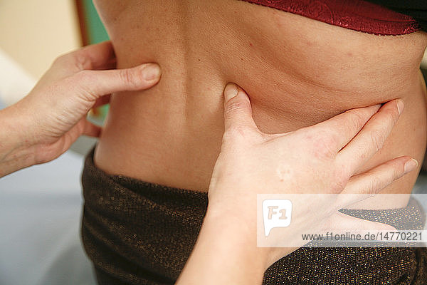ACUPUNCTURE PREGNANT WOMAN