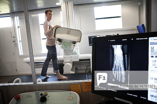 Reportage in einem Radiologiezentrum in Haute-Savoie  Frankreich. Ein Techniker röntgt den Fuß eines Patienten  der wegen eines Hallux valgus operiert wurde.