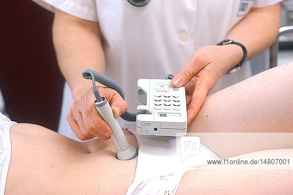 FETAL DOPPLER