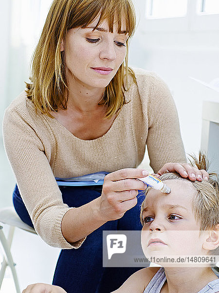 Mother applying arnica on her son´s forehead.