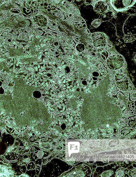 RABIES VIRUS