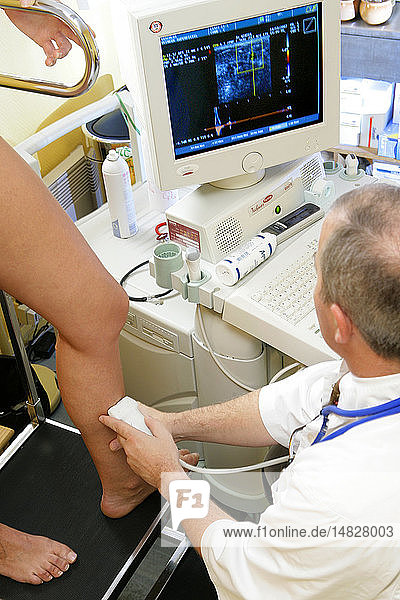 DOPPLER TEST OF A VEIN