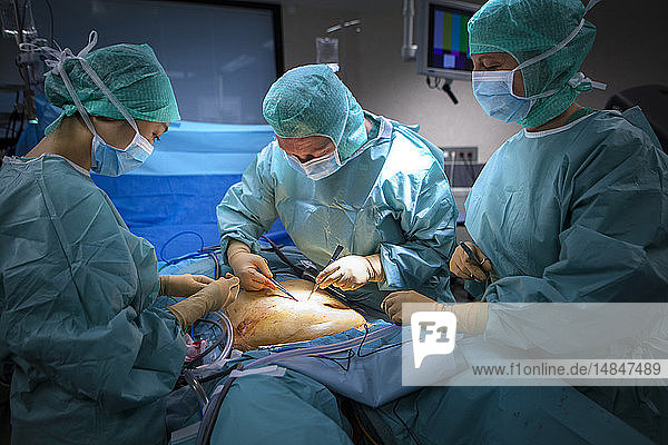 Reportage in einem Operationssaal während einer Hysterektomie mit dem da Vinci Roboter®. Nähte am Ende der Operation.