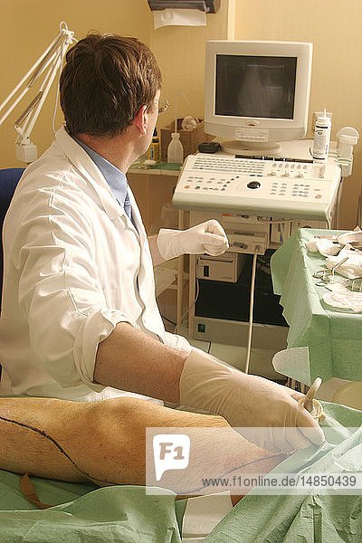DOPPLER TEST OF A VEIN