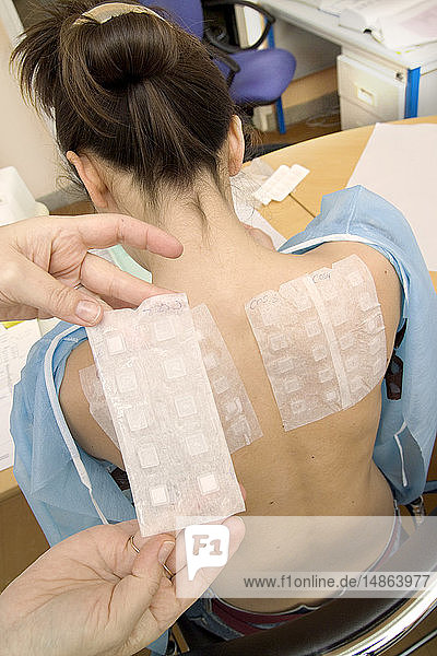 ALLERGY TEST WOMAN