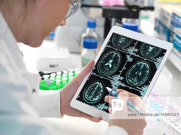 Arzt betrachtet Hirnscan des Patienten auf digitalem Tablett im Labor